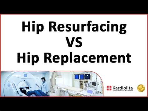Hip Resurfacing Abroad: An In-Depth Interview with a Surgeon