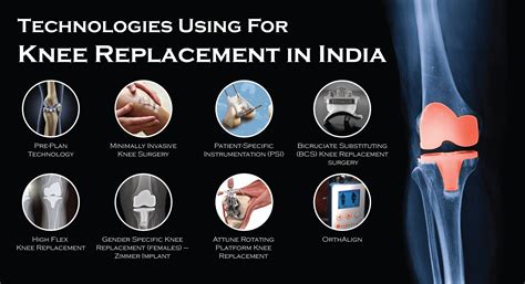 Knee Replacement in India: An In-Depth Interview with a Patient